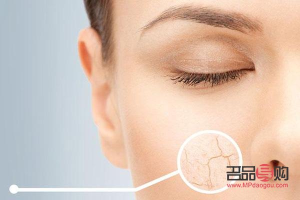 身体干燥起皮，呵护肌肤有妙招