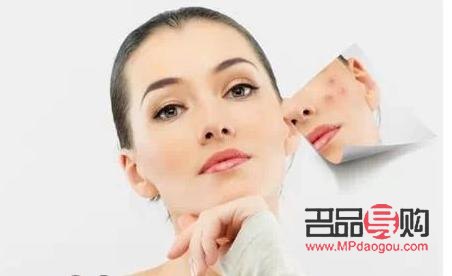 身体护理刷酸有用吗(身体护理刷酸有用吗女生)