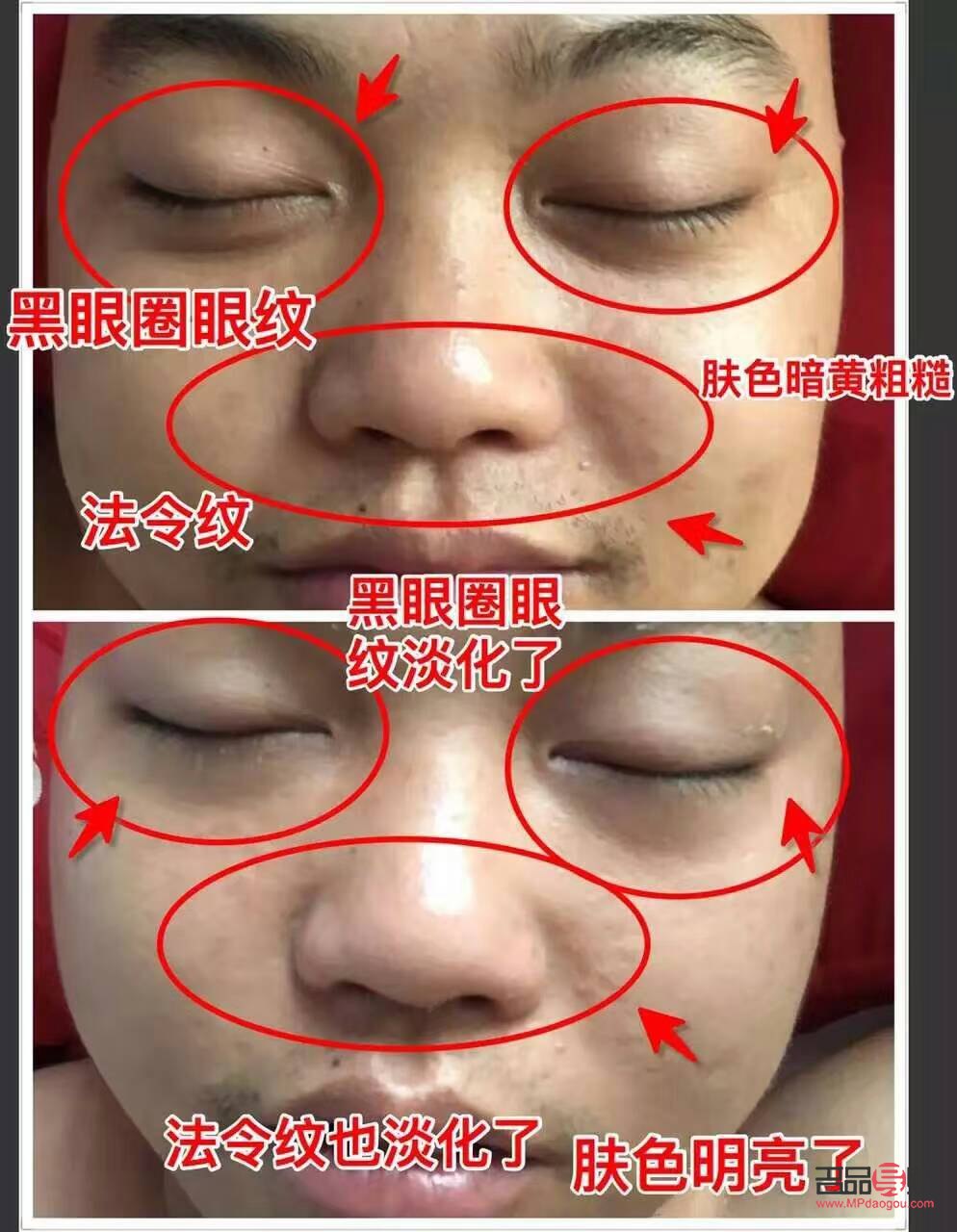 怎么针灸美容(怎么针灸美容养颜)