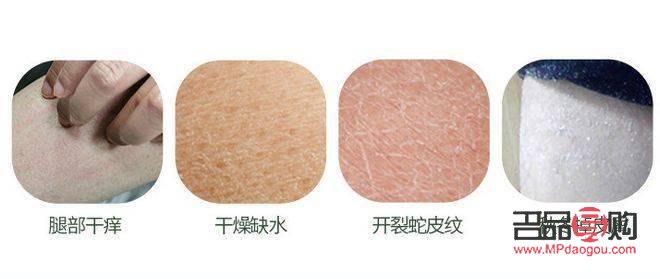 身体很干燥怎么护理(身体很干燥怎么护理好)