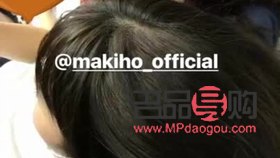 唇裂能否进行美容修复？