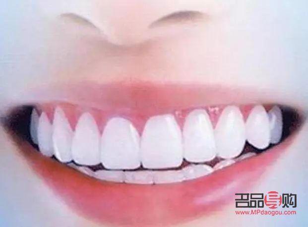 牙尖怎么美容的(牙尖怎么办有什么小妙招)