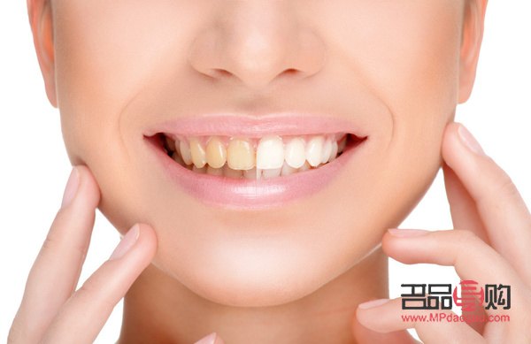 牙尖怎么美容的(牙尖怎么办有什么小妙招)