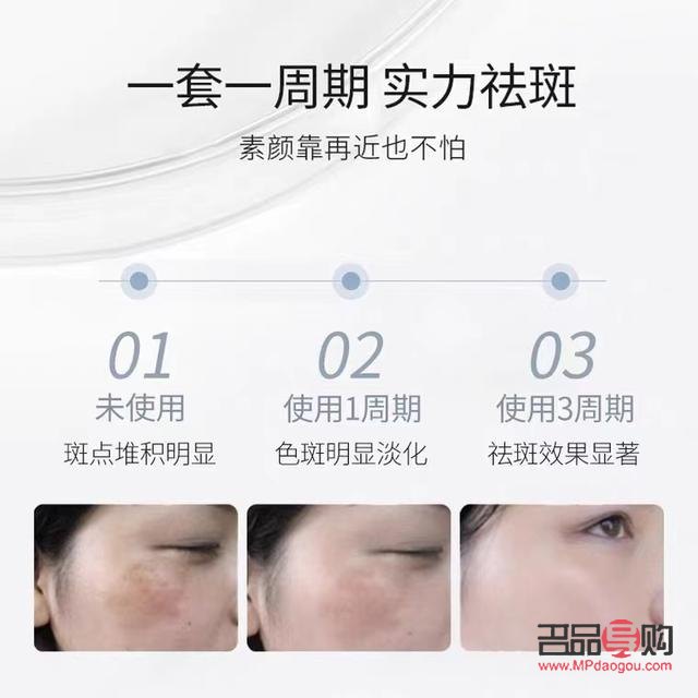 <h3>美容院祛斑全攻略：专业、安全、高效</h3>