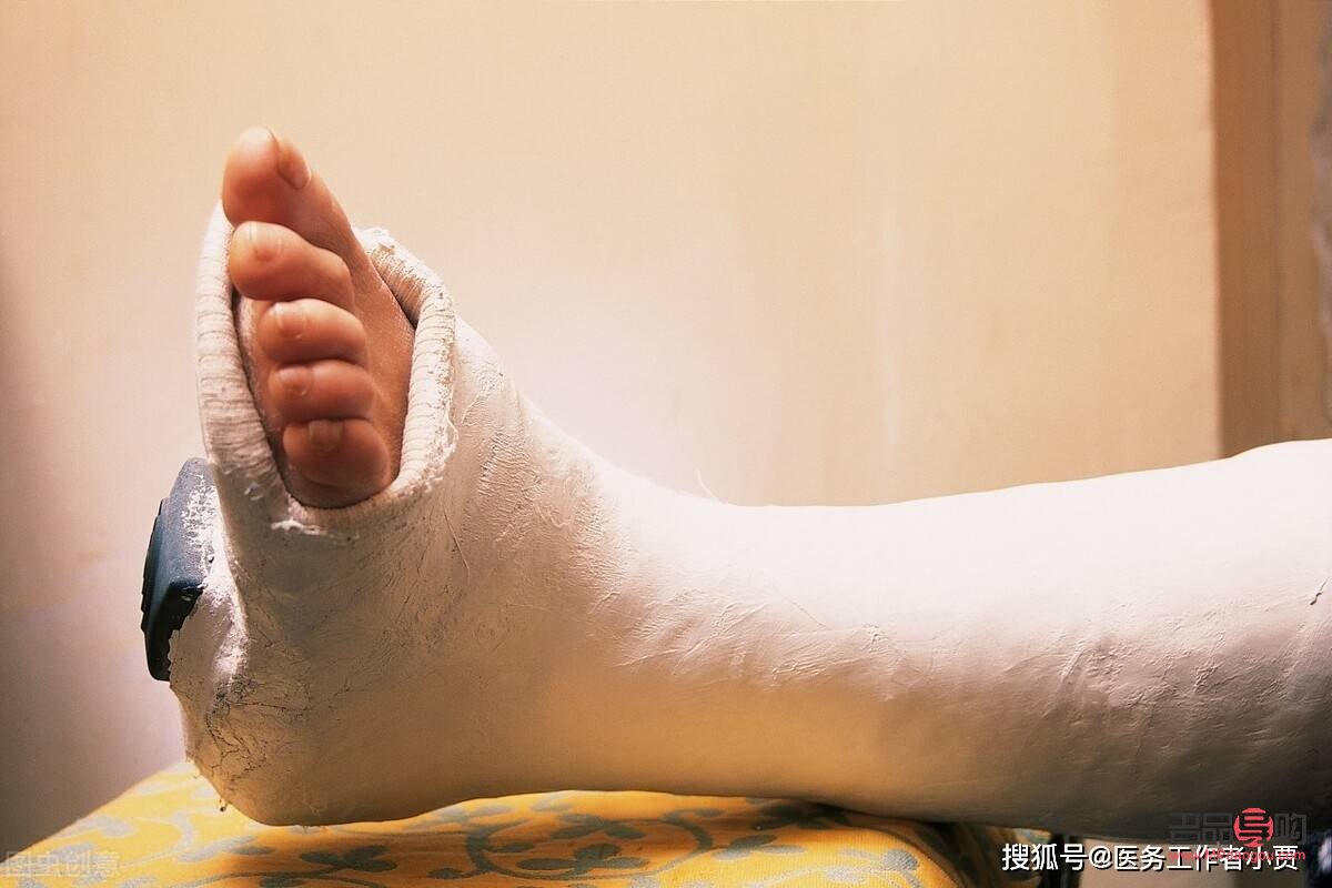 脚骨折能做身体护理吗(脚骨折能做身体护理吗视频) 脚骨折能做身体护理吗(脚骨折能做身体护理吗视频)