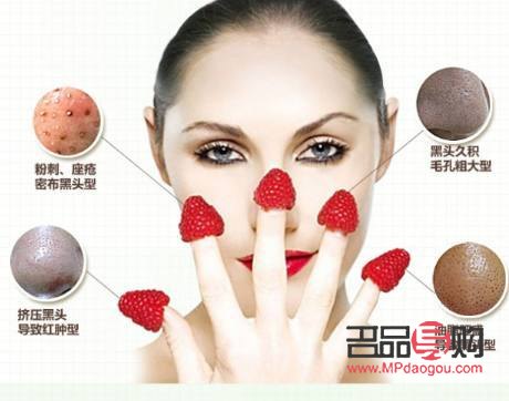 <h1>美容秘诀：如何高效去除黑头</h1>