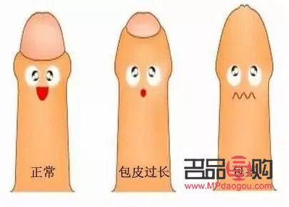 龟头美容是什么