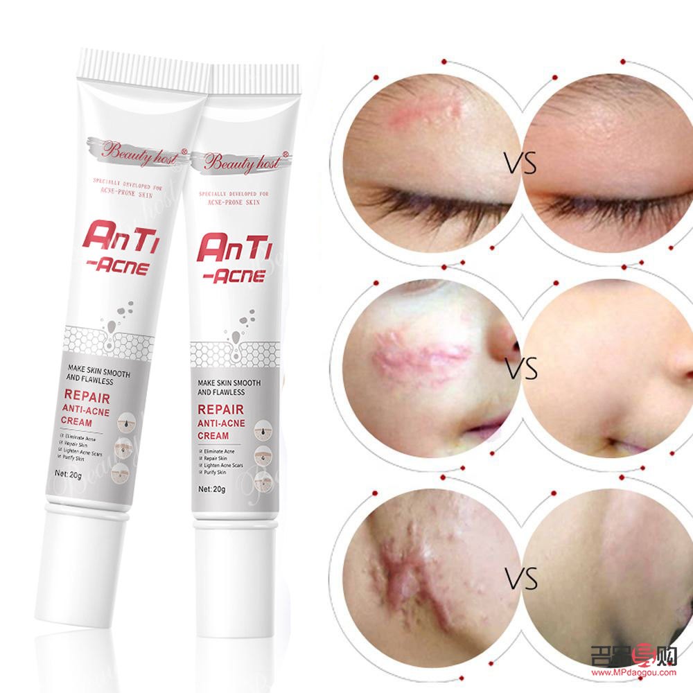 <h3>美容院去疤痕的有效方法</h3> <h3>美容院去疤痕的有效方法</h3>