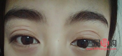 三眼皮(三眼皮怎么恢复双眼皮) 三眼皮(三眼皮怎么恢复双眼皮)