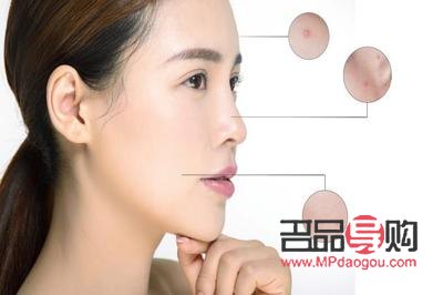 美容院怎么去粉刺(美容院怎么去粉刺的)