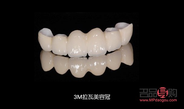 <h3>美容冠:美丽与健康的双重保障</h3> <h3>美容冠:美丽与健康的双重保障</h3>