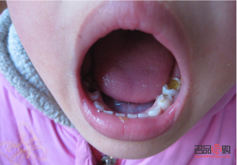 为什么要重视身体护理(为什么要重视身体护理工作) 为什么要重视身体护理(为什么要重视身体护理工作)