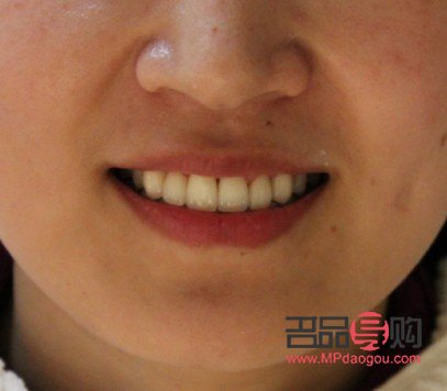 <h1>牙齿美容：绽放自信笑容的秘密武器</h1>