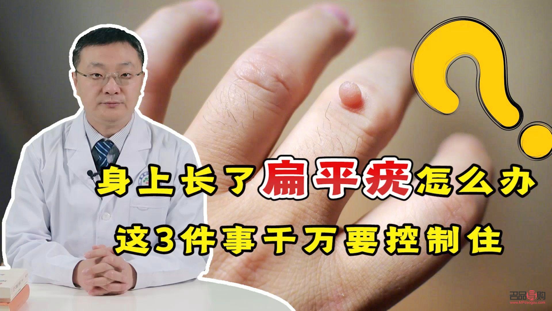 长疣怎么身体护理(长疣怎么身体护理最好)