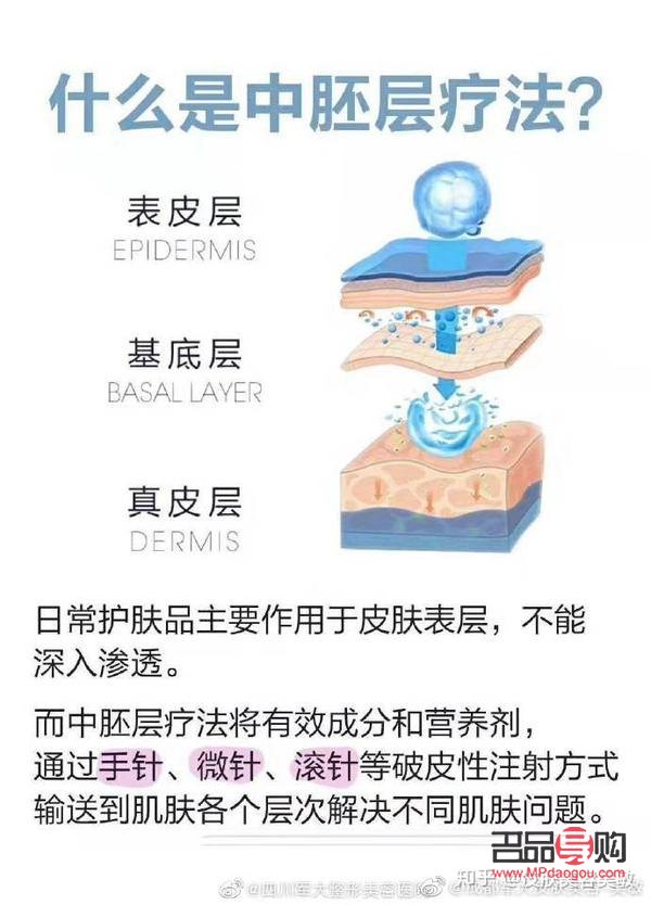什么是中胚美容(什么是中胚美容有副作用吗) 什么是中胚美容(什么是中胚美容有副作用吗)