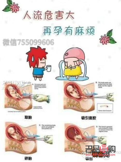 <h3>打胎后如何科学护理身体</h3>