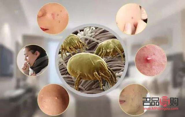 做美容去螨虫吗(做美容去螨虫吗有效果吗)