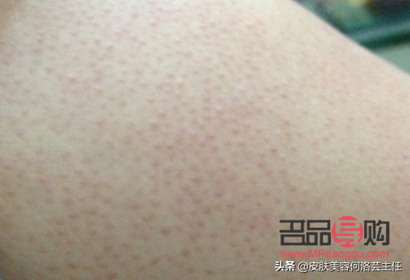 身体皮肤如何护理保养(身体皮肤如何护理保养最好)