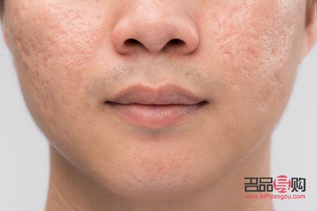 掌握面部美容技巧，焕发自然光彩