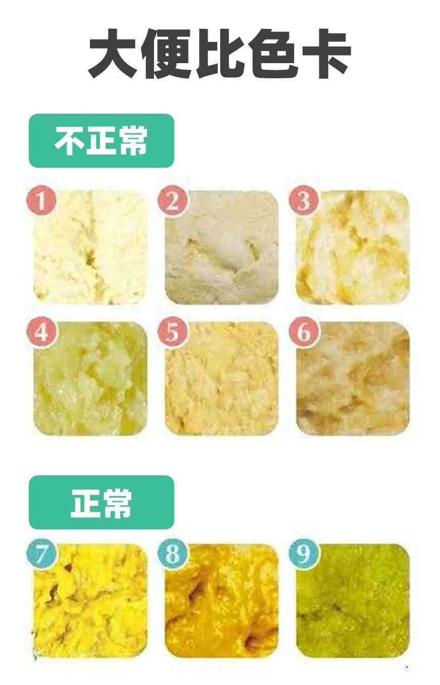 天使之吻胎记(红色胎记手按压就消失)插图13 天使之吻胎记(红色胎记手按压就消失)插图13