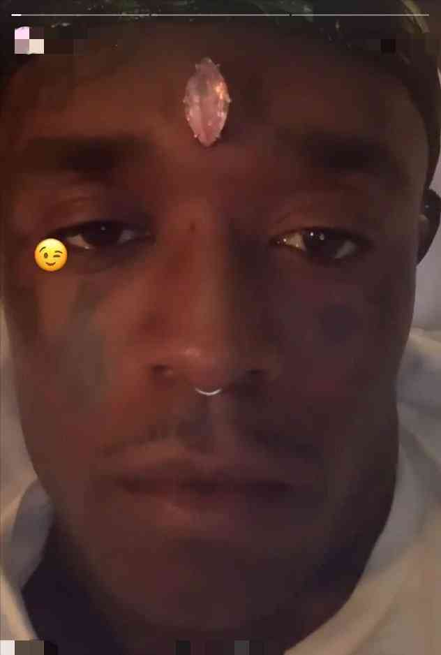 粉钻镶在脑门上(粉钻镶在脑门上是谁)插图3 粉钻镶在脑门上(粉钻镶在脑门上是谁)插图3