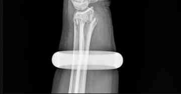 戴着玉镯睡觉的禁忌(戴玉镯睡觉会影响健康吗)插图1 戴着玉镯睡觉的禁忌(戴玉镯睡觉会影响健康吗)插图1