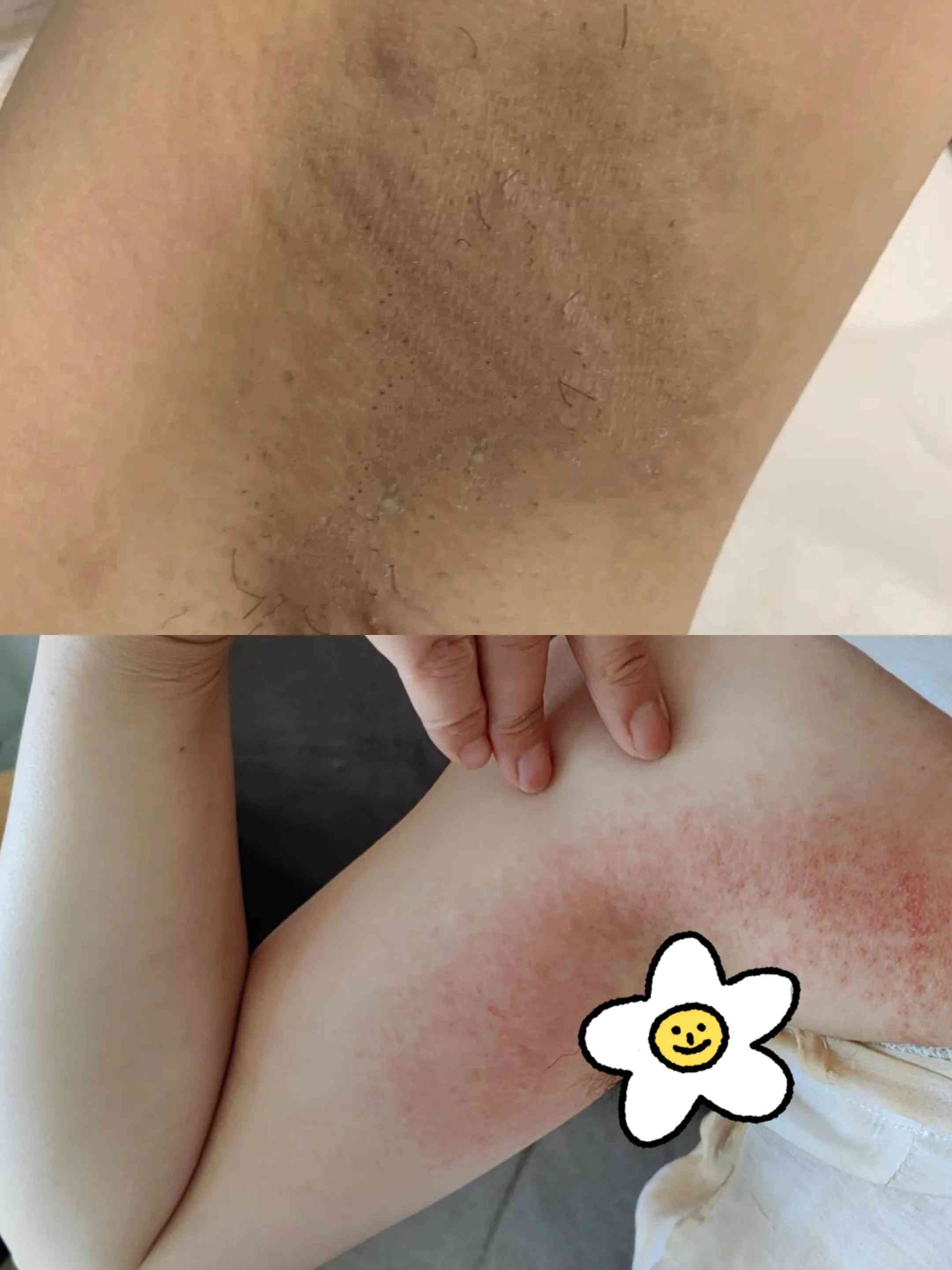 鼻头出汗化妆品推荐女(鼻头容易出汗是什么皮肤)