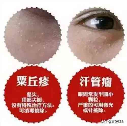 眼霜属化妆品吗(眼霜属于日用品吗)插图5 眼霜属化妆品吗(眼霜属于日用品吗)插图5