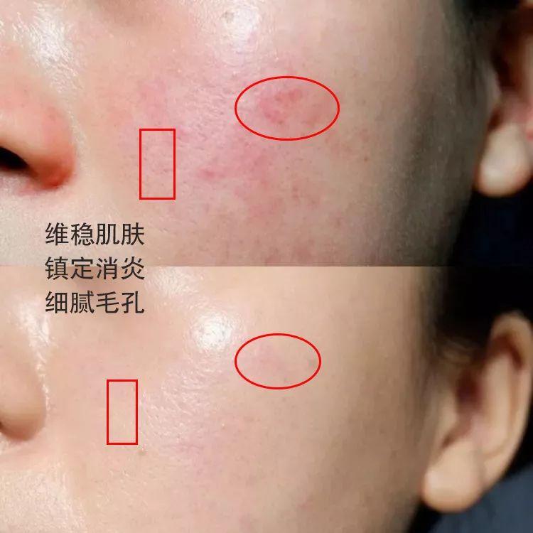 林依晨化妆品分析(林依晨妆容)插图12