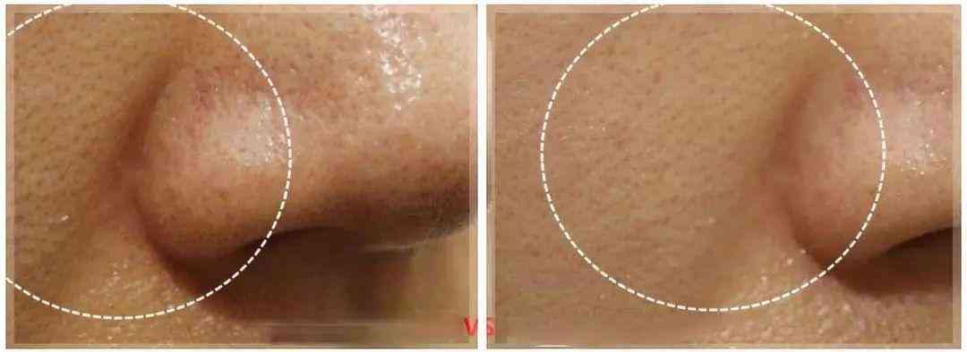 林依晨化妆品分析(林依晨妆容)插图31