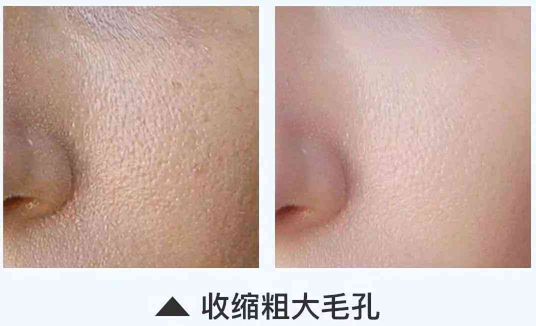 林依晨化妆品分析(林依晨妆容)插图32