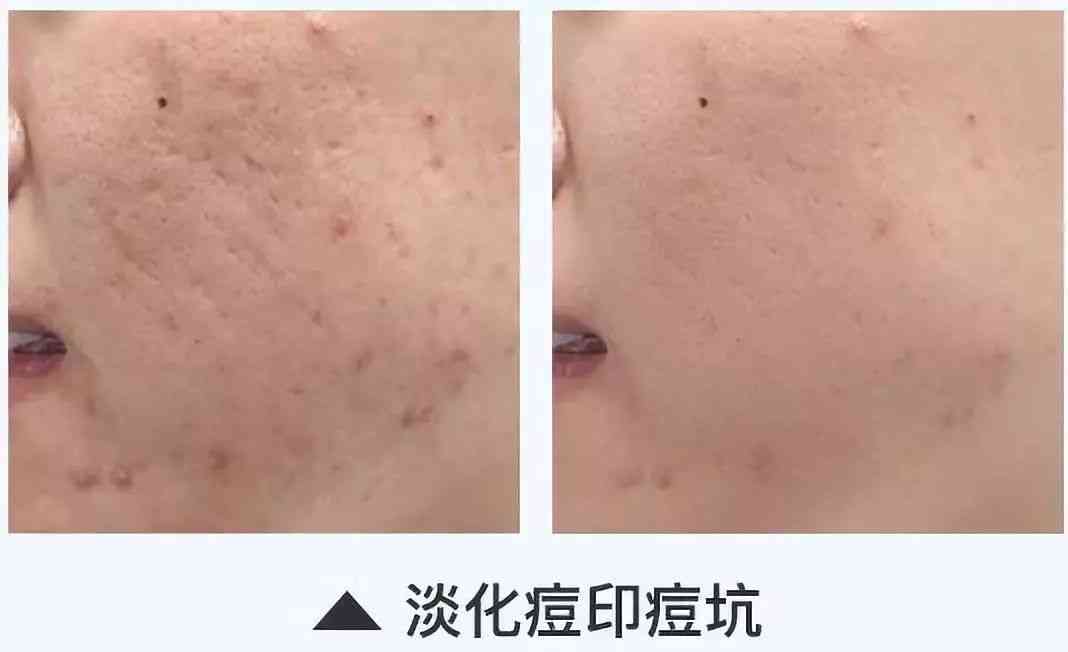 林依晨化妆品分析(林依晨妆容)插图33