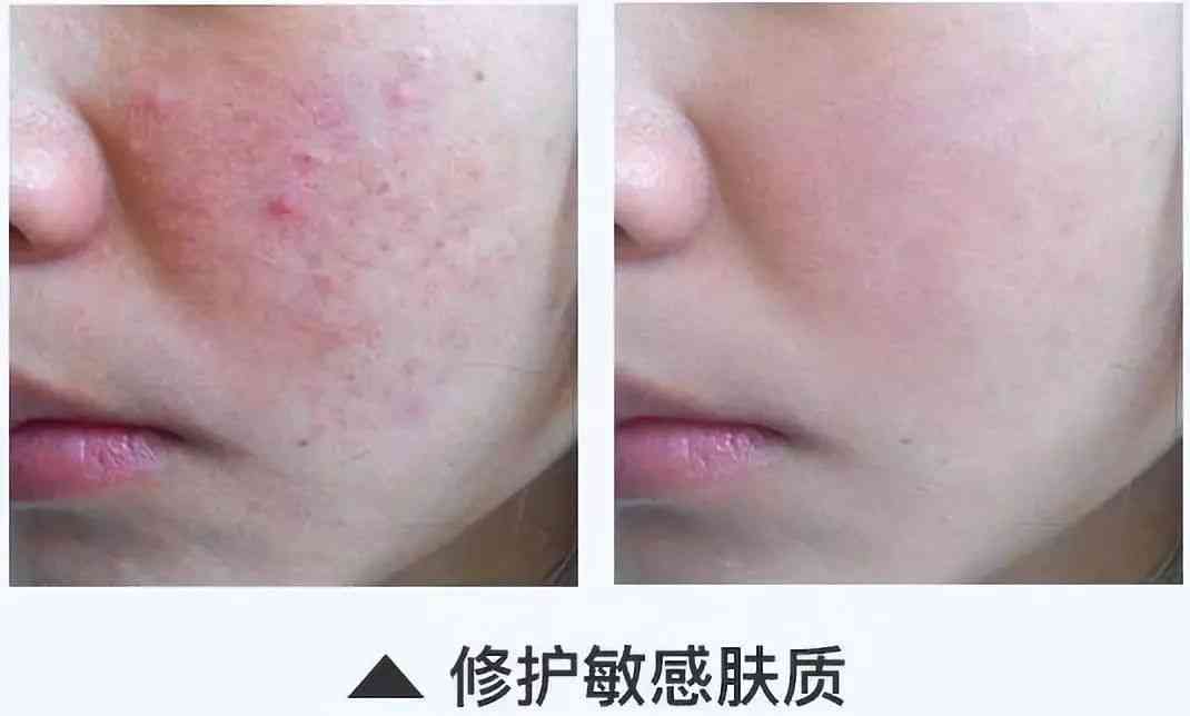 林依晨化妆品分析(林依晨妆容)插图34