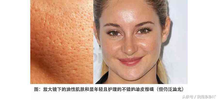 化妆品皮试位置图(护肤品皮试操作流程)