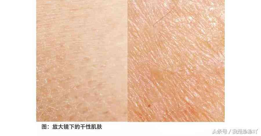 化妆品皮试位置图(护肤品皮试操作流程)插图1