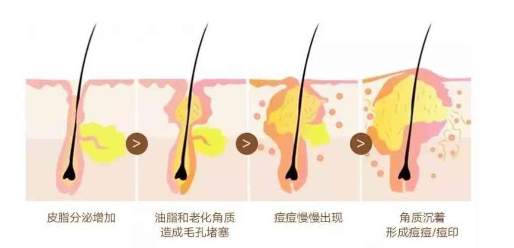 化妆品可以去油脂吗(油脂的皮肤用什么化妆品好)插图3