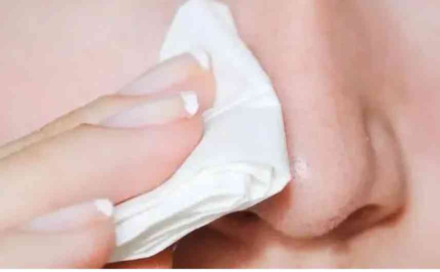 化妆品可以去油脂吗(油脂的皮肤用什么化妆品好)插图8