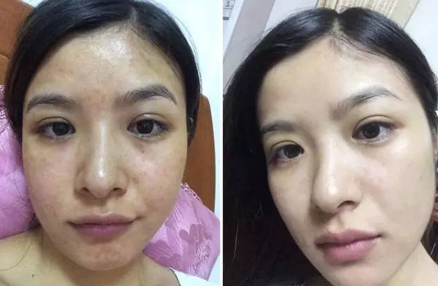 林心如现在用哪品牌化妆品(林心如曾经代言的化妆品品牌)插图23 林心如现在用哪品牌化妆品(林心如曾经代言的化妆品品牌)插图23