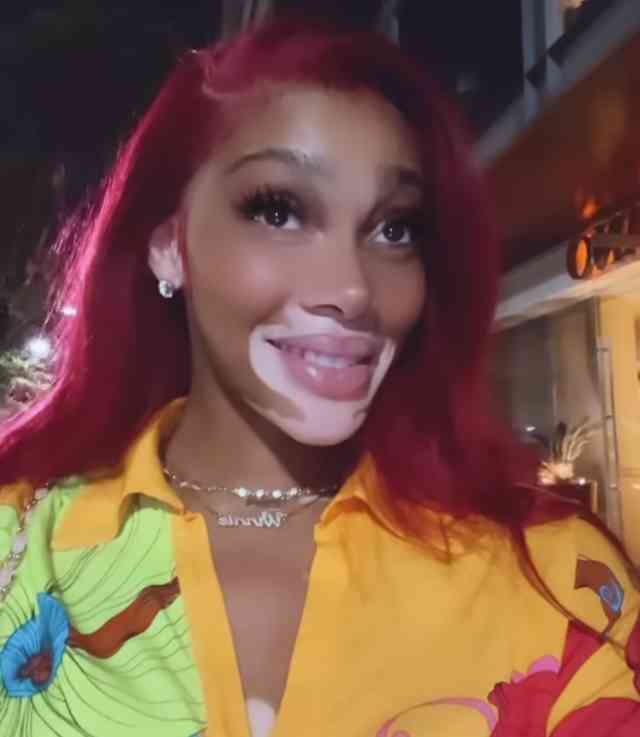 无名指戴戒指意味着什么(无名指戴戒指是什么意思)