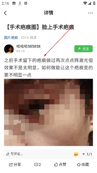 中国疤痕论坛